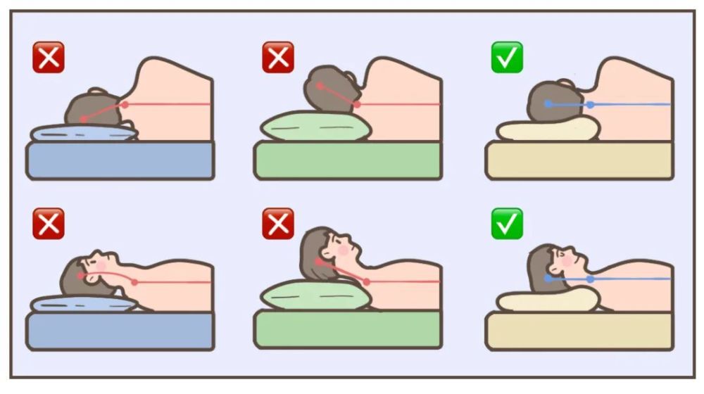 颈椎病的睡姿正确方法图片