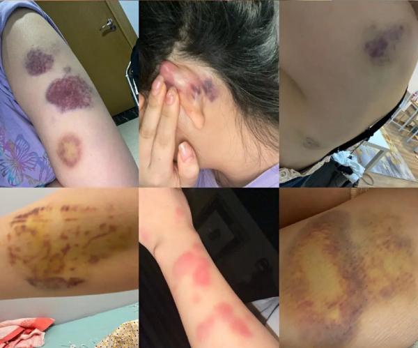 女子举报大学院长之子家暴:让跪下学狗叫,喝香水