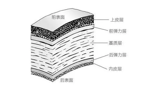 兰州爱尔：近视了有多痛苦？如何医治(图3)
