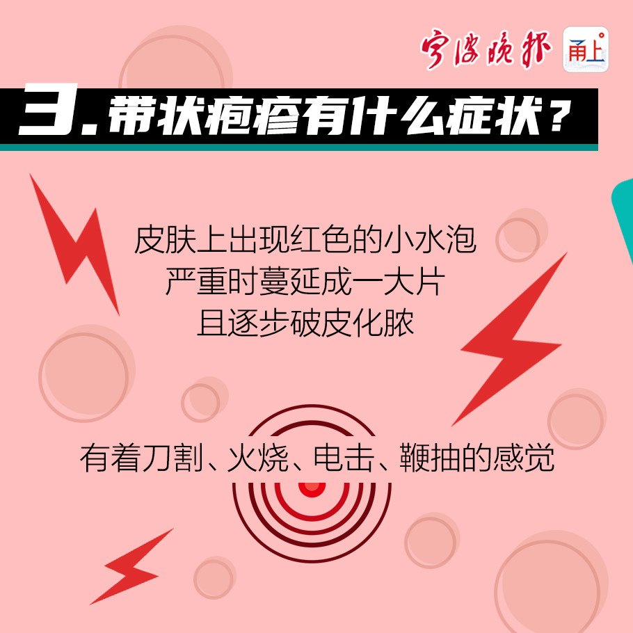 一圖讀懂小心疼痛難忍的帶狀皰疹近期高發這些你需要知道