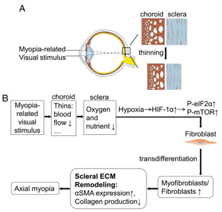肌成纤维细胞转分化模式参与近视的发病机制a 近视视觉刺激过程中巩膜