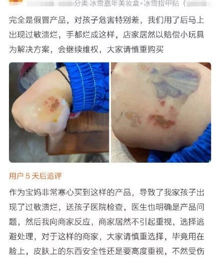 皮肤溃烂铅中毒矮小症销量暴涨300网红儿童美妆谋财害人