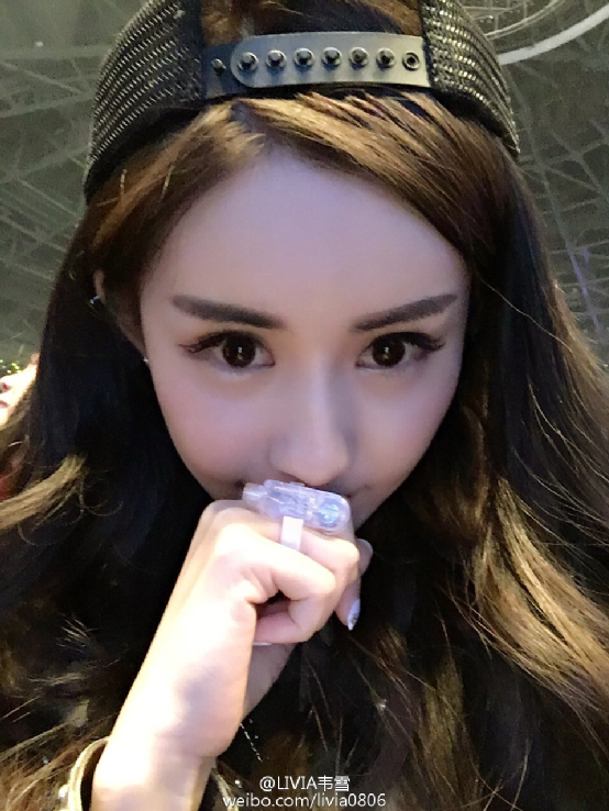 韦雪东施效颦,在脸上大刀阔斧,整成了"小杨幂".