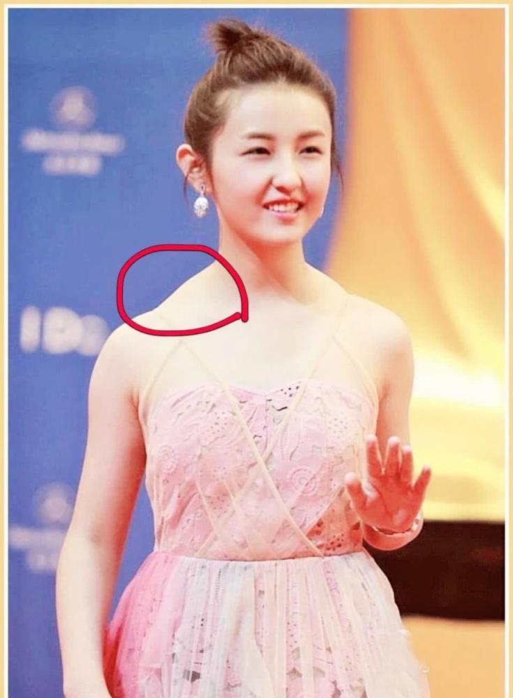 都是芭蕾舞出身,为什么刘诗诗和吴谨言的斜方肌差别这么大