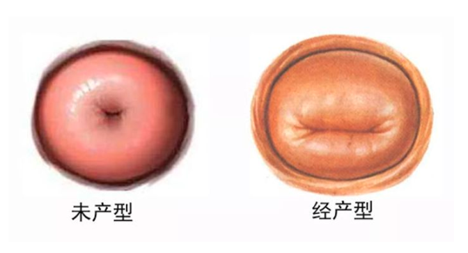 宝妈产检陷入纠结:婚前有流产史,可我不想让老公和医生知道