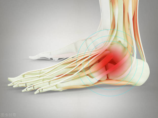 想想都疼得跟腱斷裂你知道多少有這三種修復手術