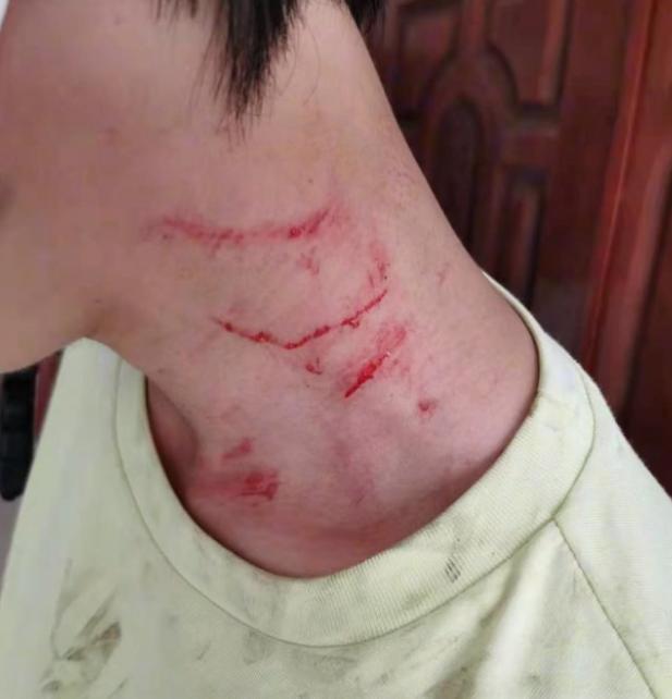 安徽安庆:大妈插队被拒打伤工作人员,进派出所后又叫人来继续打