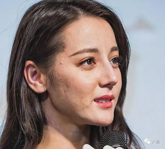 明星大量未修图曝光,热巴毛孔闭口一堆,杨幂皮肤松垮