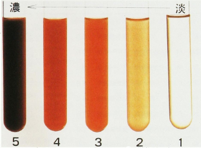 如果有这种表现,有可能是肝功能下降引起,此时血液中胆红素浓度增高