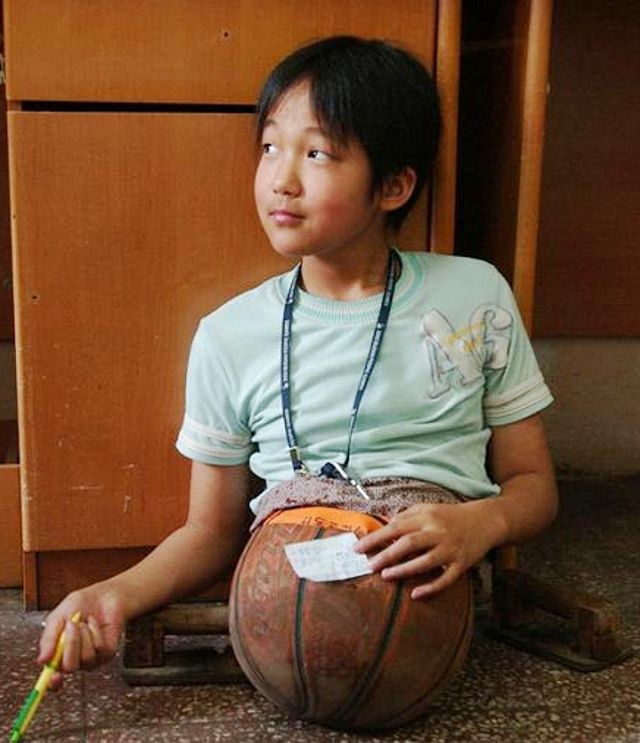 为了"行走",爷爷给她套上了篮球,她被人们称为勇敢的"篮球女孩".