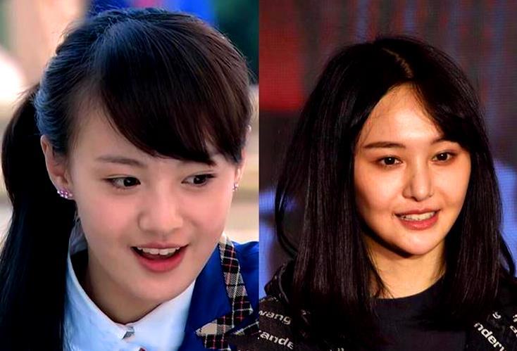 99亿照片曝光,整容导致苹果肌僵硬?自曝不能生育