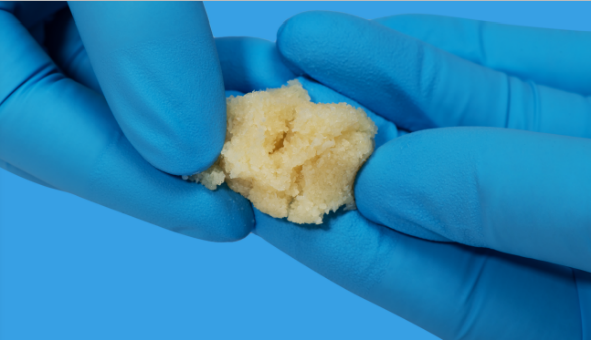 脱钙骨粒膏冻:容易塑型,对于范围较小,边界不齐的骨质缺损尤其适合.