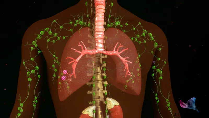 淋巴結腫大是腫瘤信號?這些情況要當心