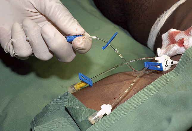 插入患者颈椎的深静脉导管年轻医师根基不牢的必然