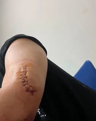 上的外卖,李先生说,自己还没来得及回答,"他就抽出一把刀向我脖子砍来