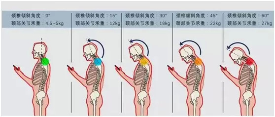 并且,颈部的弯曲度越大,颈椎的承重也越大.