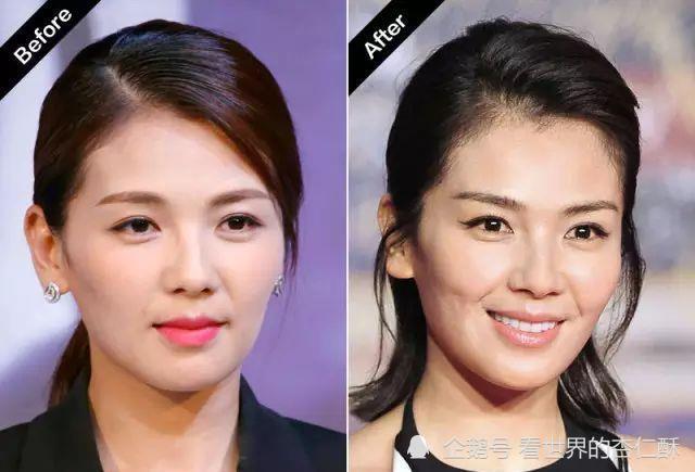 刘涛高颧骨女星的颜值沉浮