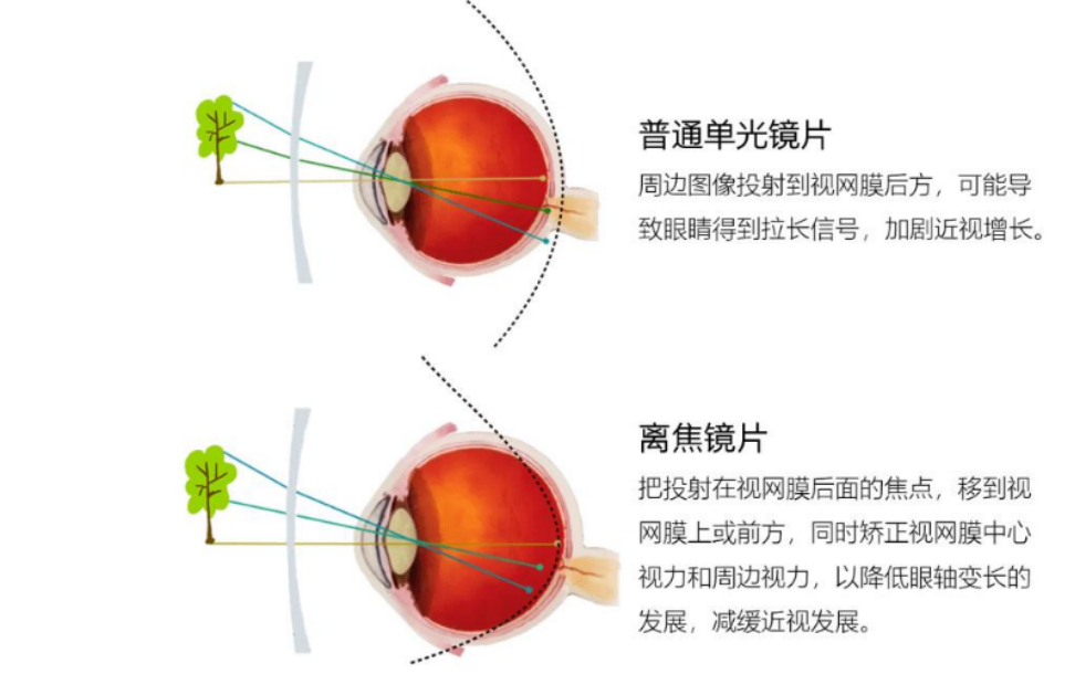 怎么配眼镜,怎么配眼镜最划算