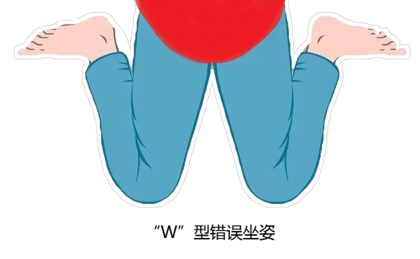 三,内八字治疗方法:(一)日常姿势管理避免w坐姿,趴睡姿势,禁止使用