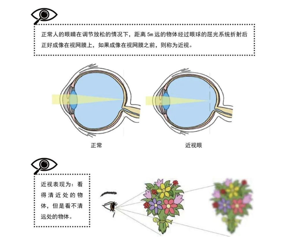 開學第一課愛眼隨聲聽近視照相機成像在視網膜之前