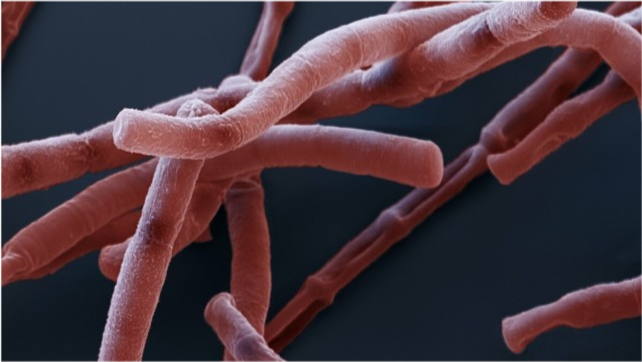 山东滨州出现炭疽死亡病例,炭疽传染性有多强?牛羊肉还能吃吗?