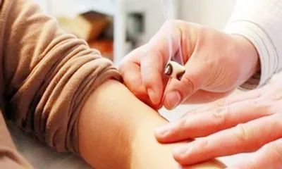 滑膜炎针灸效果怎么样,滑膜炎用什么药治疗最好最快