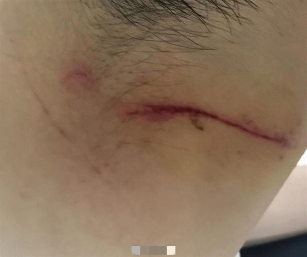 兰州交通大学一研究生遇害,校方与受害人家属就善后事宜达成共识