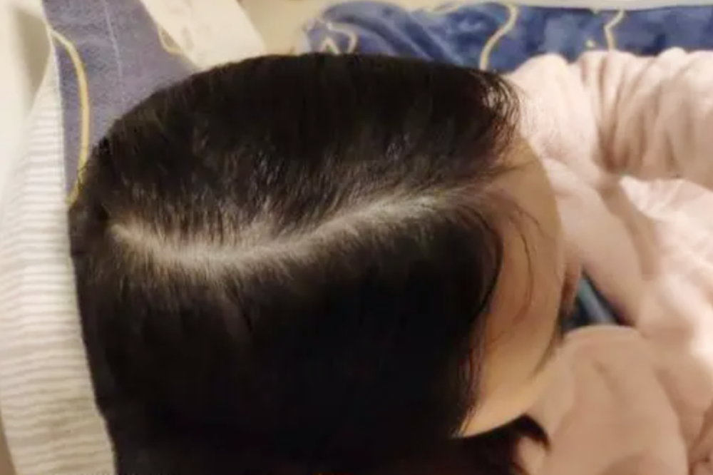 孩子头发"老鼠尾",暗示性格特征_腾讯新闻