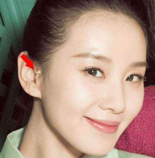 孩子出生100天我割掉了她的小耳朵拴马桩非福气别迷信了