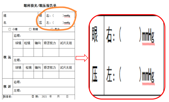 矫正视力是什么意思,矫正视力是什么意思1.0