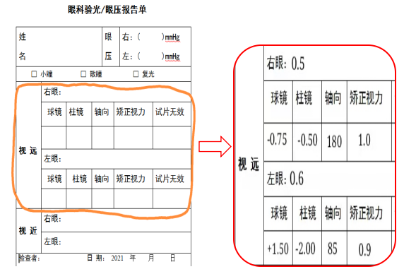 矫正视力是什么意思,矫正视力是什么意思1.0