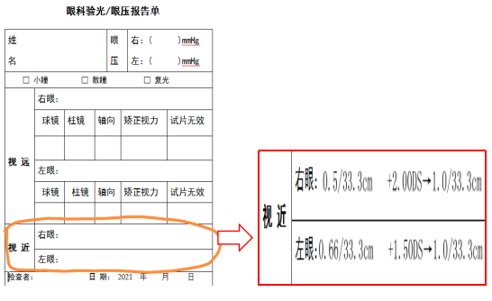 矫正视力是什么意思,矫正视力是什么意思1.0