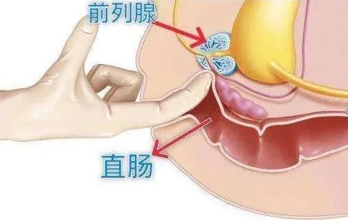 其外形看起来像一颗栗子,上面紧邻膀胱,向下渐变成尿道,后面靠着直肠