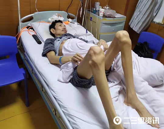商洛一大叔被罕见病折磨多年他用生命呐喊我想活下去