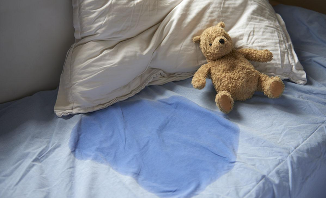 患有儿童遗尿症,会频繁夜间尿床,尿湿衣服,家长需要提高警惕