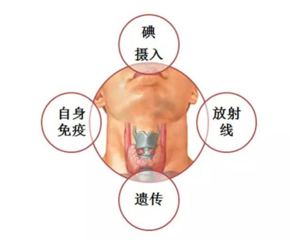 甲狀腺結節的病因有很多,如情緒波動大,高血壓/糖尿病等引發的炎症