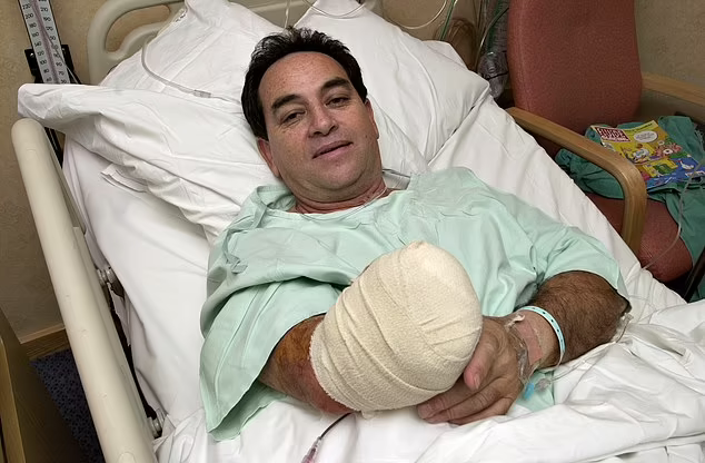 世界首例手臂移植者去世,移植后不适应,2001年又切除_腾讯新闻