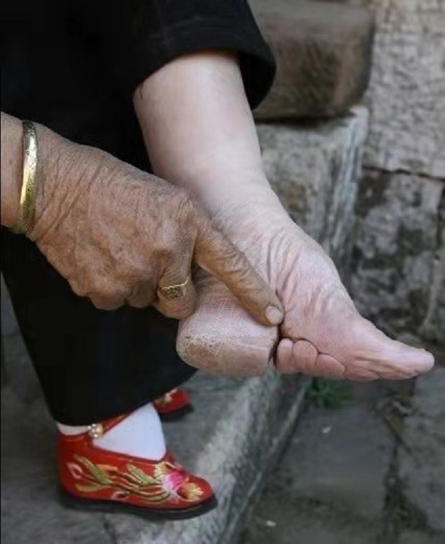 我国最后一位裹脚女性15岁靠三寸金莲嫁豪门洗脚疼到崩溃