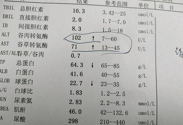 轉氨酶高是什麼原因造成的多半和這8個因素有關早知道早預防