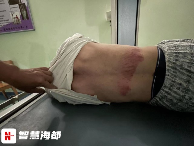 区万达广场4楼一商铺内,正在做吊顶装修的工友从高处摔落,腰部受伤