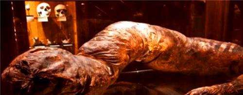 他是唯一被憋死的人36个月没排泄粪便重36斤尸检后发现真相