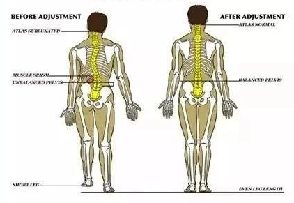骨盆不正問題正在危害我們的身體!你該瞭解一下自己的骨盆了