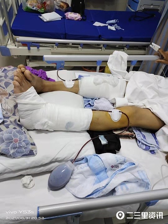 工地意外受伤10万多医药费谁来垫付负责人积极协调此事