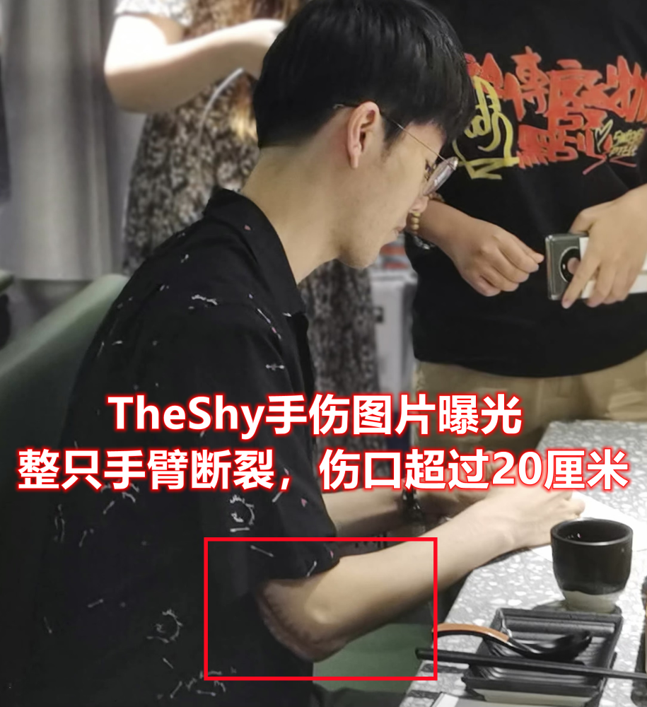 theshy手伤原因图片