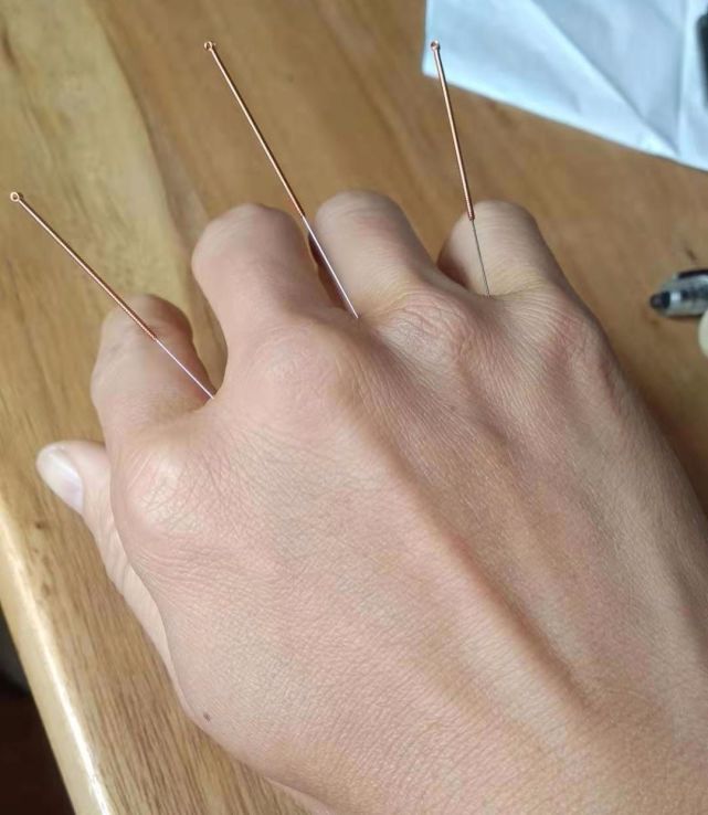 治疗手指麻木的特效穴,效果立竿见影.|针灸|穴位|坐骨神经痛|八邪