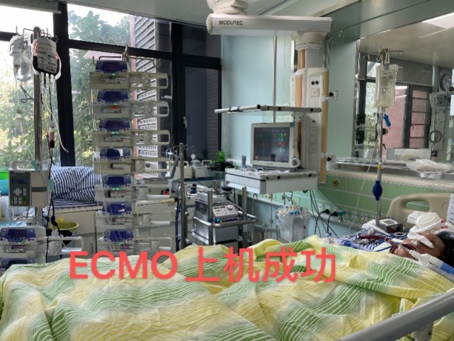 ecmo(体外膜肺氧合治疗设备)已安置成功.