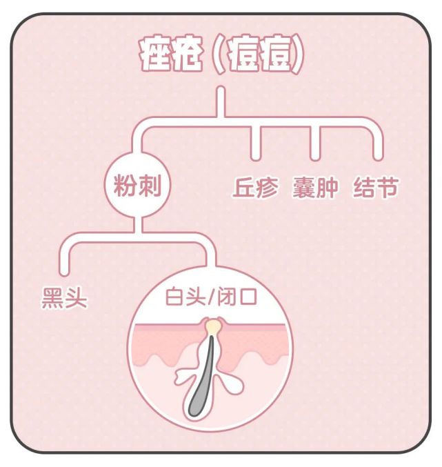 反反复复长闭口，到底应该怎么办？_腾讯新闻