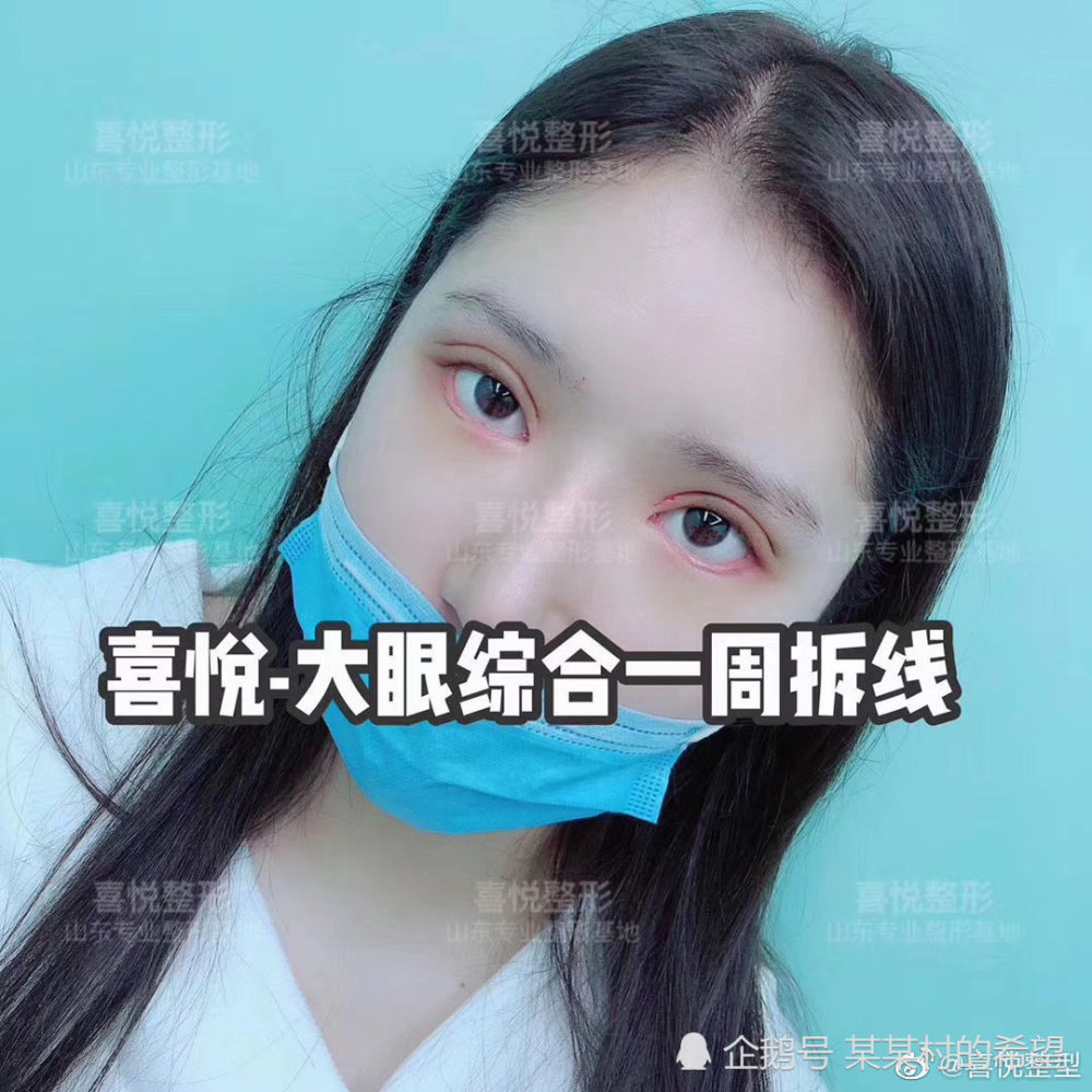 女子整形失败投诉,竟遭店老板威胁