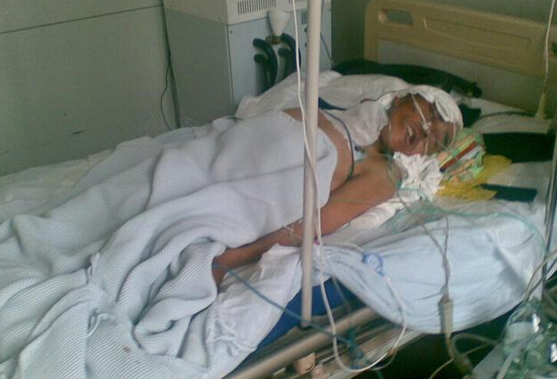 确诊肺癌晚期别放弃!这样做,或可有效减轻痛苦,实现长期生存!