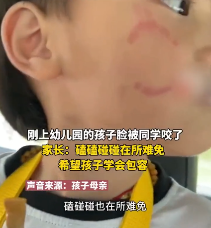 刚上幼儿园就被咬伤家长心疼却能忍没找老师和对方孩子应学会包容